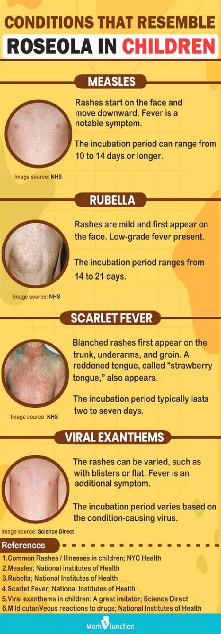 Can you get roseola twice?
