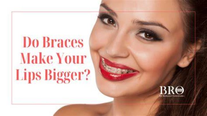 Do your lips get bigger with braces?