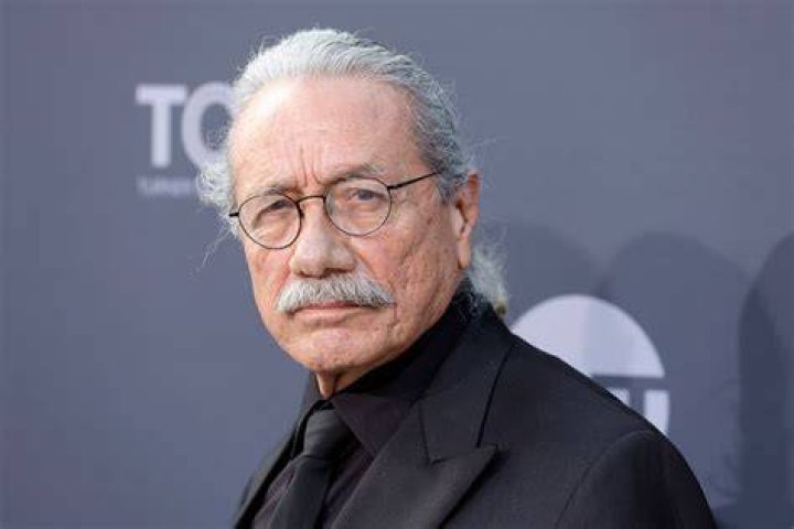 Edward James Olmos Skin | Edward James Olmos Scars