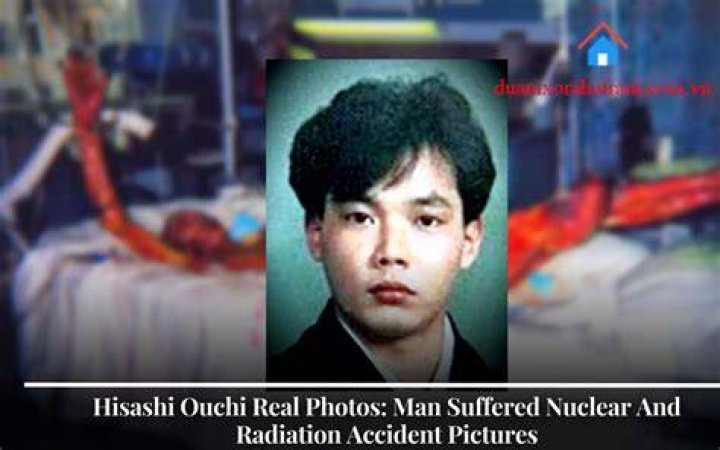 Hisashi Ouchi The Real Story Behind His Photos