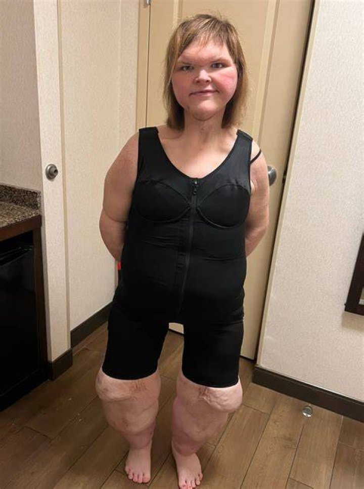 Tammy Slaton of '1000-lb Sisters' in a blue top