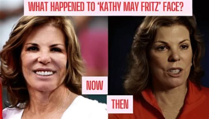 Taylor Fritz Mum Face Surgery: A Comprehensive Look At The Transformation