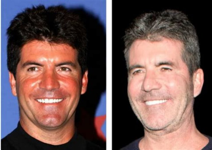 Understanding Simon Cowell's Son's Illness A Comprehensive Overview