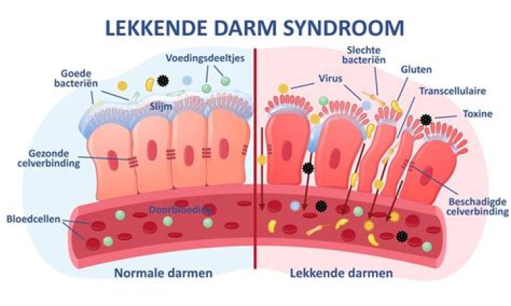 Wat Doen Gluten Met Je Darmen?