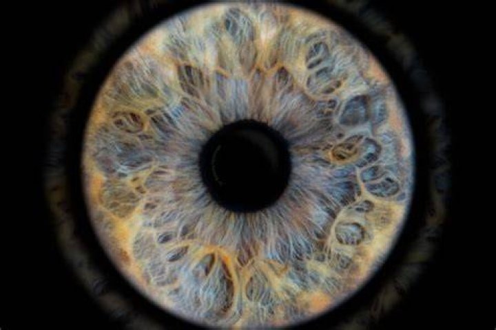 Wat Is Een Iris?