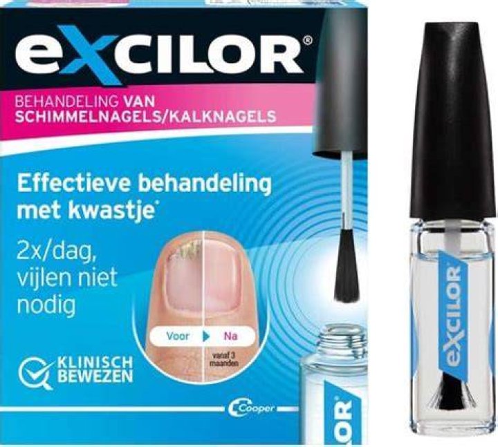 Wat Is Het Beste Product Voor Kalknagels?