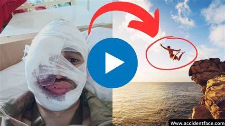 WATCH Face Split Diving Accident Incident Of 2009 Original Video