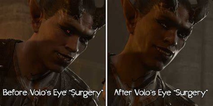 Where is Volo after eye surgery?